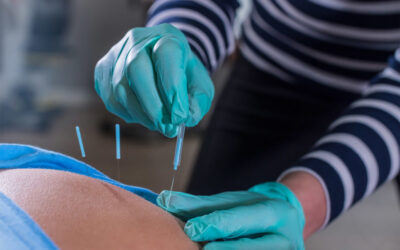 Is Dry Needling the Right Pain Treatment for Me?